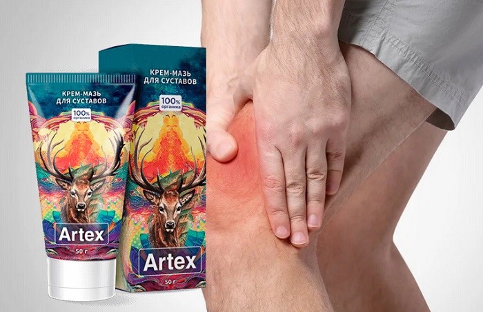 Artex